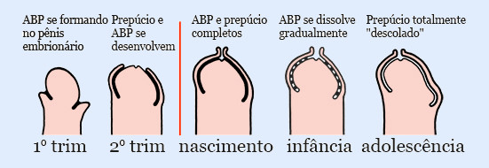 Desenvolvimento da aderencia no penis infantil